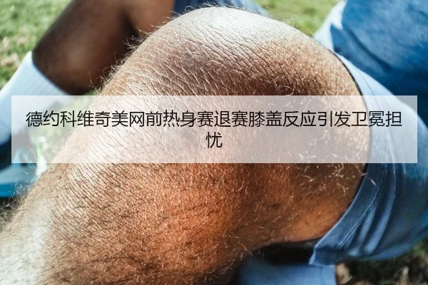 德约科维奇美网前热身赛退赛膝盖反应引发卫冕担忧